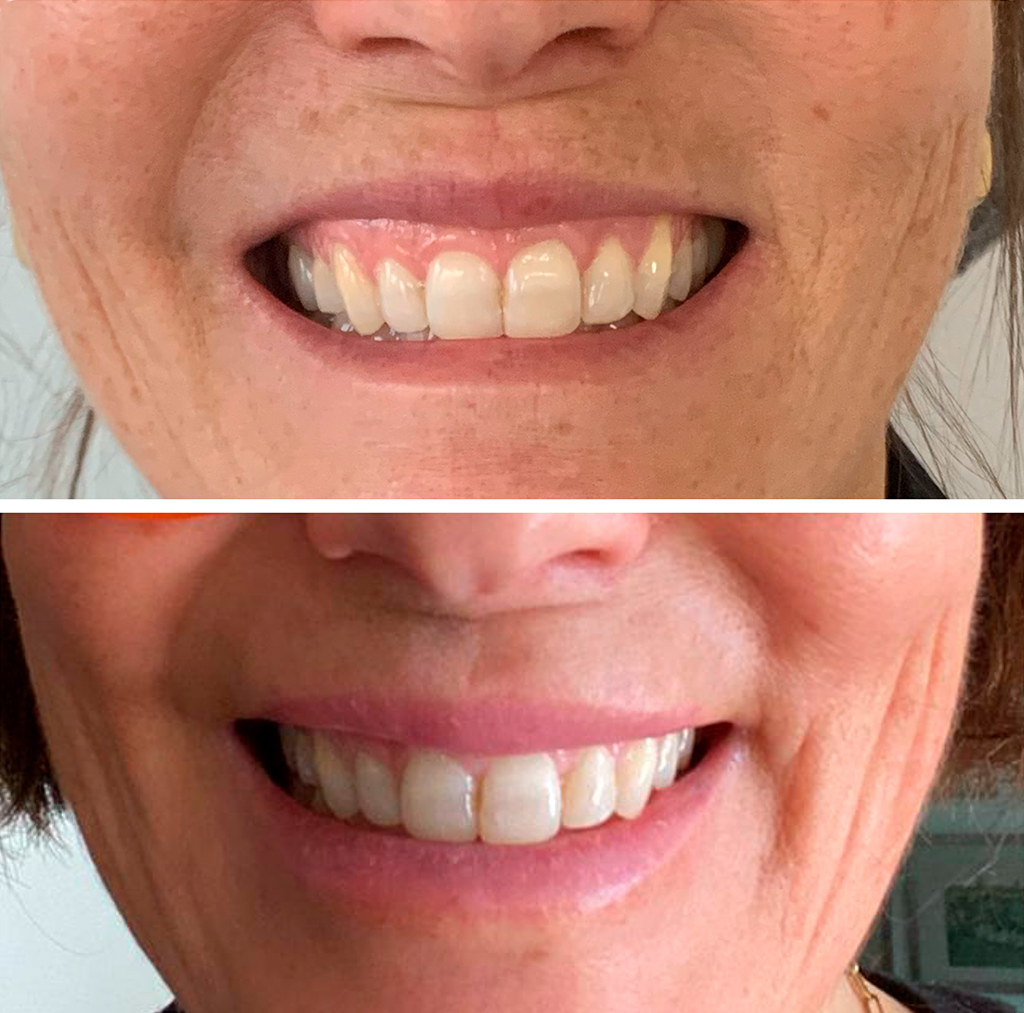 Un resultado bello y natural