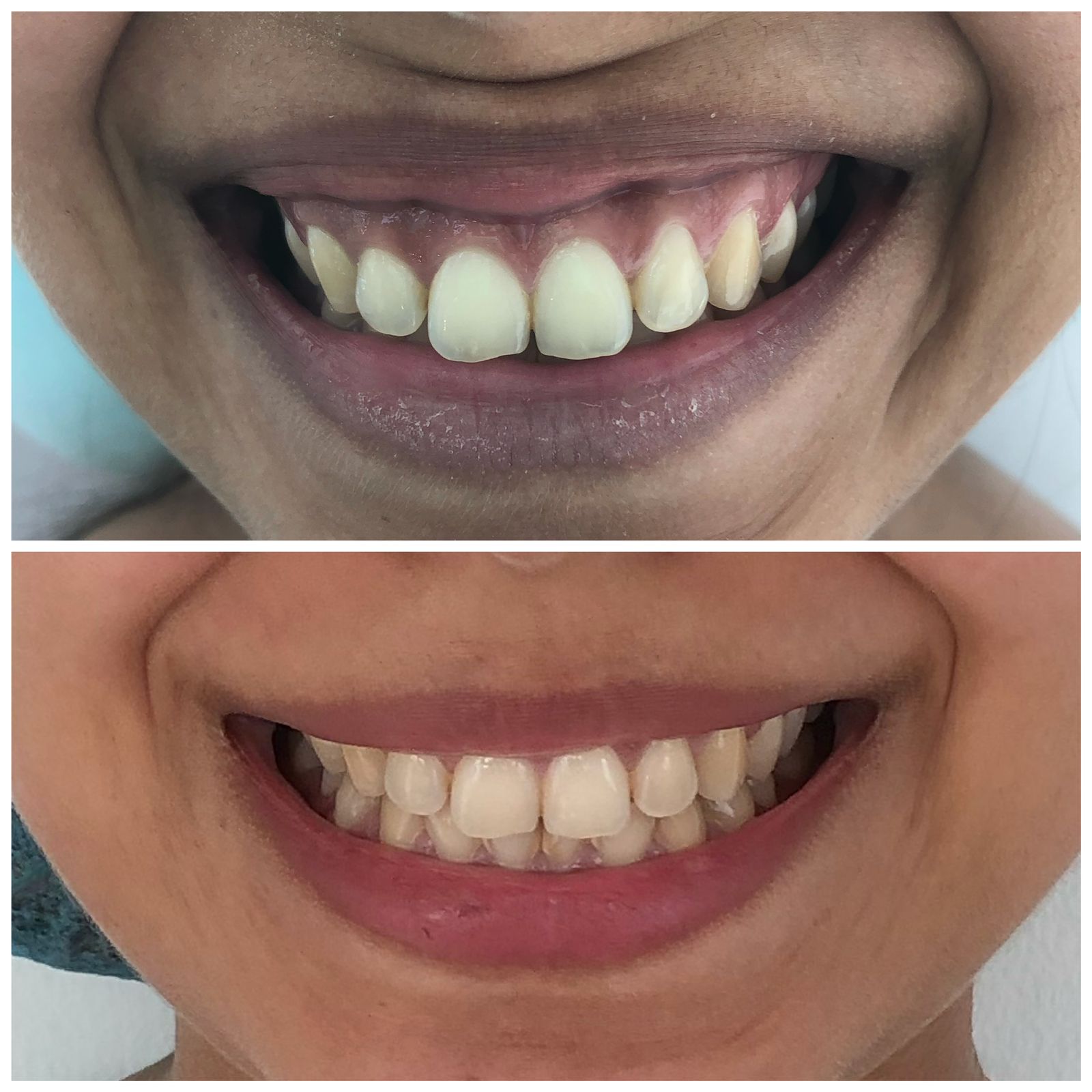 Sonrisa involuntaria